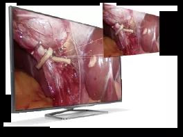 腹腔镜都有什么品牌厚积薄发 ｜ 鹰利视原研4K腹腔镜摄像系统比肩进口产品！_https://www.jmylbn.com_新闻资讯_第1张